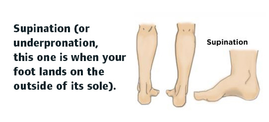 supination insoles uk