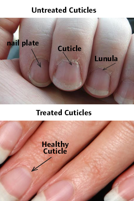 cuticles