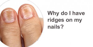 What are spooned shaped nails? | Feetlife Foot and Nail Care